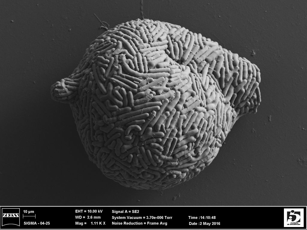 A scanning electron micrograph of a Lesquereusia spiralis shell, side view, the aperture is facing right. You can see the pattern of construction using endogenously produced sausage-shaped silica particles, pieced together with a porous cement. Anush Kosakyan